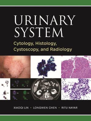 cover image of Urinary System